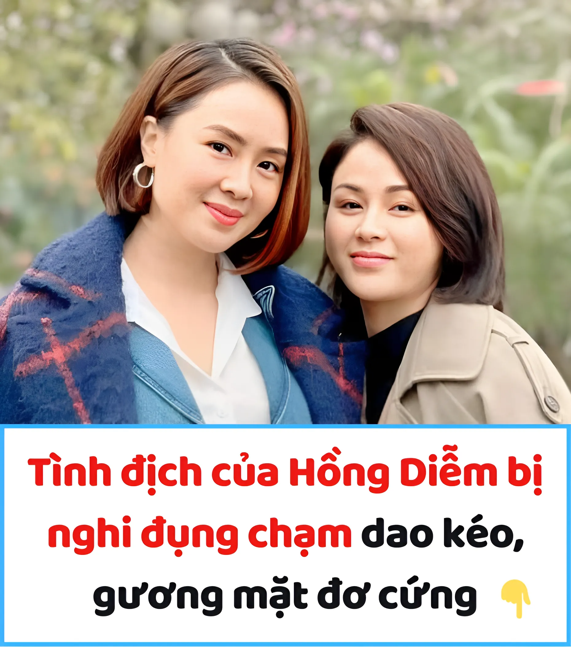 Tình địch của Hồng Diễm bị nghi đụng chạm dao kéo, gương mặt đơ cứng